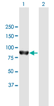 Western blot - Anti-PTPN22 antibody (AB169040)
