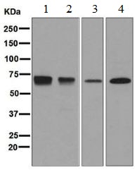 Western blot - Anti-PTPRE antibody [EPR6715] - BSA and Azide free (AB248184), expandable thumbnail