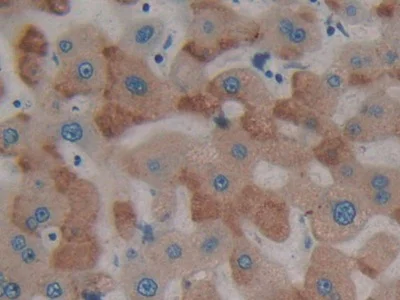 Immunohistochemistry (Formalin/PFA-fixed paraffin-embedded sections) - Anti-PTPRH antibody (AB231723)