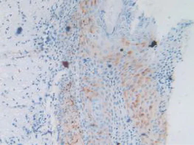 Immunohistochemistry (Formalin/PFA-fixed paraffin-embedded sections) - Anti-PTPRH antibody (AB231723)