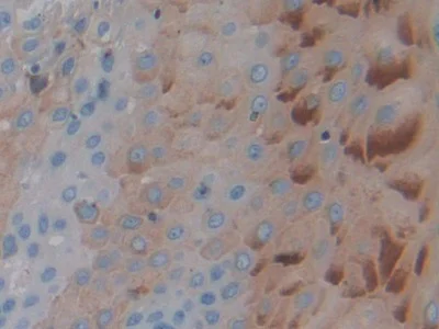 Immunohistochemistry (Formalin/PFA-fixed paraffin-embedded sections) - Anti-PTPRH antibody (AB231723)
