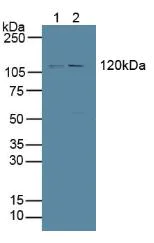 Western blot - Anti-PTPRH antibody (AB231723)