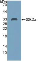 Western blot - Anti-PTPRH antibody (AB231723)