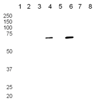 Western blot - Anti-PTPRK antibody (AB13225)