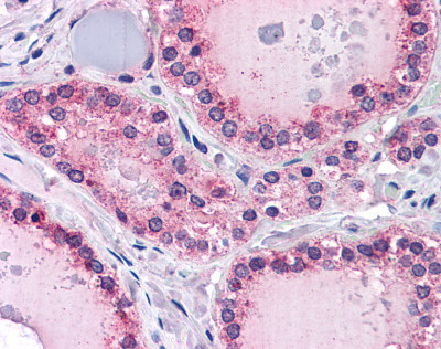 Immunohistochemistry (Formalin/PFA-fixed paraffin-embedded sections) - Anti-PTPRM antibody (AB111207)