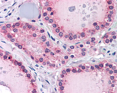 Immunohistochemistry (Formalin/PFA-fixed paraffin-embedded sections) - Anti-PTPRM antibody (AB111207)