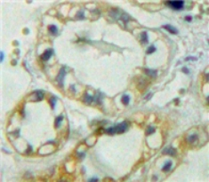 Immunohistochemistry (Formalin/PFA-fixed paraffin-embedded sections) - Anti-PTPRM antibody (AB231607)