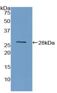 Western blot - Anti-PTPRM antibody (AB231607)