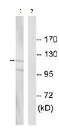 Western blot - Anti-PTPRN2 antibody (AB230360), expandable thumbnail