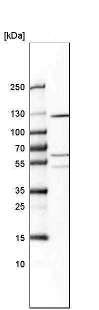 Western blot - Anti-PTPRN2 antibody (AB244293)