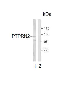Western blot - Anti-PTPRN2 antibody (AB92652), expandable thumbnail