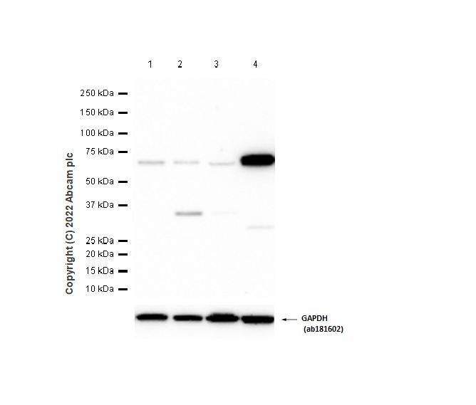 Western blot - Anti-PTPRR/PCPTP1 antibody [EPR13188] - BSA and Azide free (AB250146), expandable thumbnail
