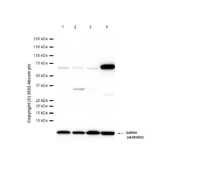 Western blot - Anti-PTPRR/PCPTP1 antibody [EPR13188] - BSA and Azide free (AB250146)