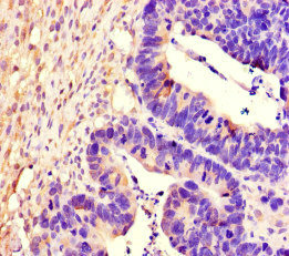 Immunohistochemistry (Formalin/PFA-fixed paraffin-embedded sections) - Anti-PTPRS antibody (AB222798)