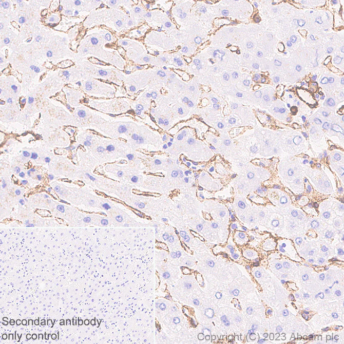 Immunohistochemistry (Formalin/PFA-fixed paraffin-embedded sections) - Anti-PTRF antibody [EPR27006-67] (AB308623)