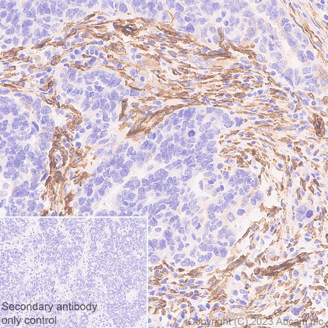 Immunohistochemistry (Formalin/PFA-fixed paraffin-embedded sections) - Anti-PTRF antibody [EPR27006-67] (AB308623)