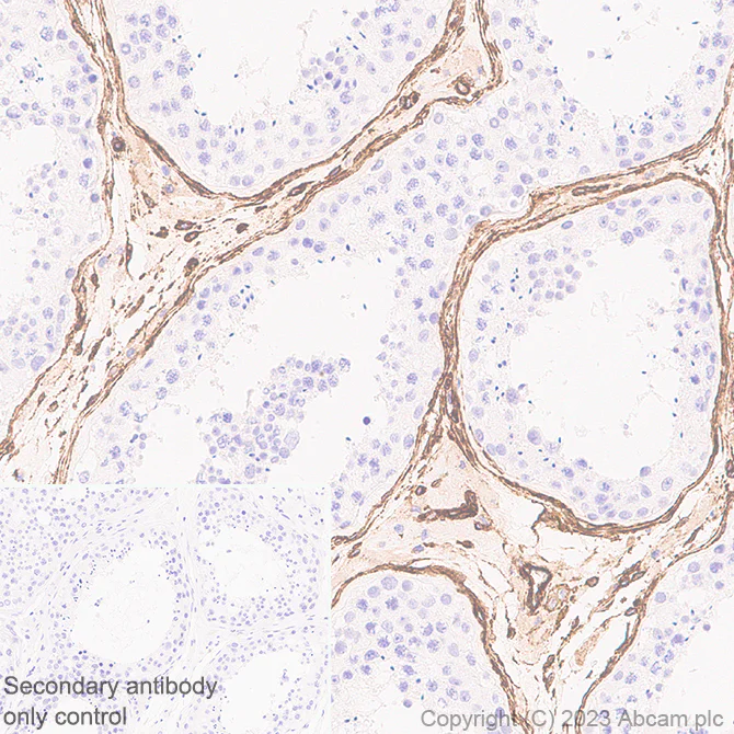 Immunohistochemistry (Formalin/PFA-fixed paraffin-embedded sections) - Anti-PTRF antibody [EPR27006-67] (AB308623)