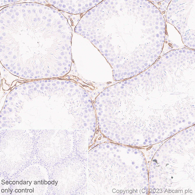 Immunohistochemistry (Formalin/PFA-fixed paraffin-embedded sections) - Anti-PTRF antibody [EPR27006-67] (AB308623)
