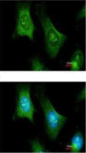 Immunocytochemistry/ Immunofluorescence - Anti-PTS/PTPS antibody (AB96104)