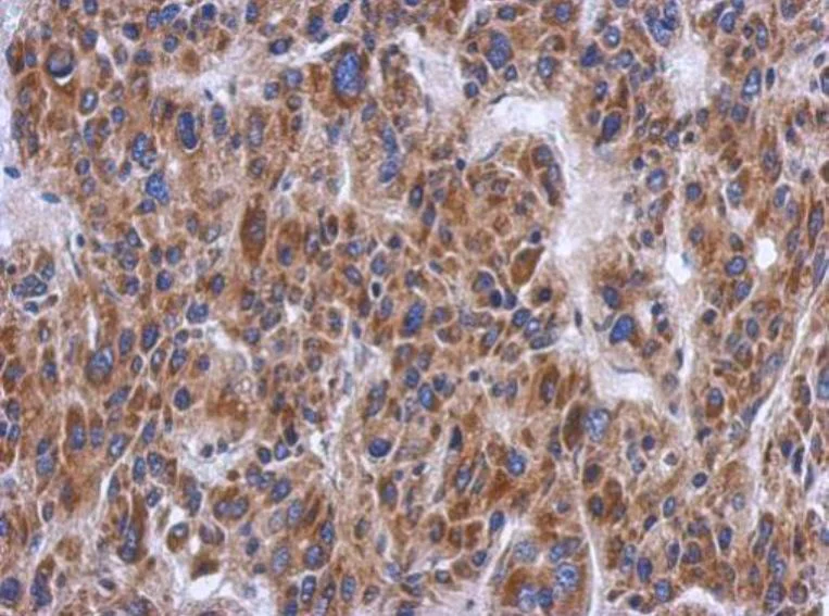 Immunohistochemistry (Formalin/PFA-fixed paraffin-embedded sections) - Anti-PTS/PTPS antibody (AB96104)