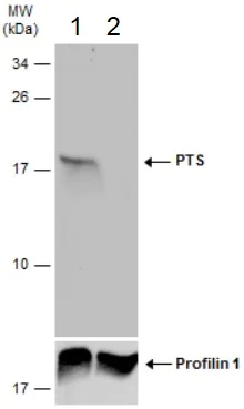 Western blot - Anti-PTS/PTPS antibody (AB96104)