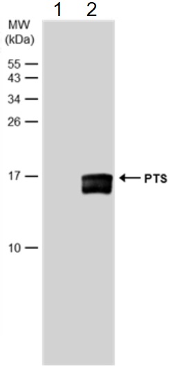 Western blot - Anti-PTS/PTPS antibody (AB96104)