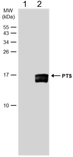 Western blot - Anti-PTS/PTPS antibody (AB96104)