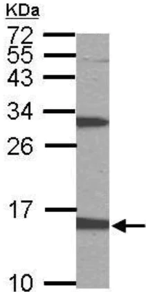 Western blot - Anti-PTS/PTPS antibody (AB96104)