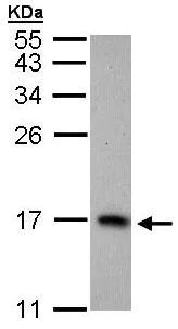 Western blot - Anti-PTS/PTPS antibody (AB96104)