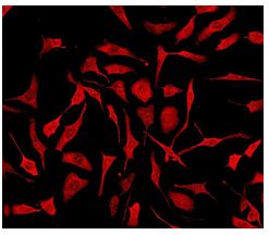 Immunocytochemistry/ Immunofluorescence - Anti-PTS/PTPS (phospho S19) antibody [EPR1517(2)] (AB109462), expandable thumbnail