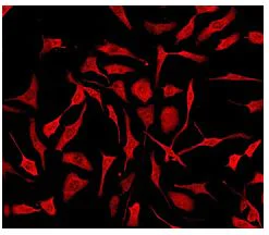 Immunocytochemistry/ Immunofluorescence - Anti-PTS/PTPS (phospho S19) antibody [EPR1517(2)] (AB109462)