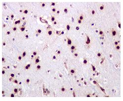 Immunohistochemistry (Formalin/PFA-fixed paraffin-embedded sections) - Anti-PTS/PTPS (phospho S19) antibody [EPR1517(2)] (AB109462), expandable thumbnail