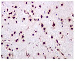 Immunohistochemistry (Formalin/PFA-fixed paraffin-embedded sections) - Anti-PTS/PTPS (phospho S19) antibody [EPR1517(2)] (AB109462)