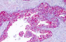 Immunohistochemistry (Formalin/PFA-fixed paraffin-embedded sections) - Anti-PTTG1IP antibody (AB128040)