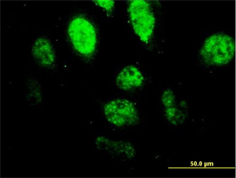 Immunocytochemistry/ Immunofluorescence - Anti-PU.1/Spi1 antibody [2G1] (AB88082), expandable thumbnail