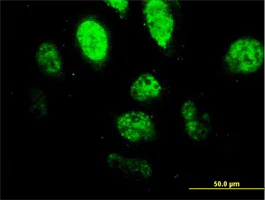 Immunocytochemistry/ Immunofluorescence - Anti-PU.1/Spi1 antibody [2G1] (AB88082)