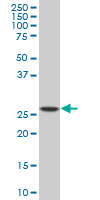 Western blot - Anti-PU.1/Spi1 antibody [2G1] (ab88082), expandable thumbnail
