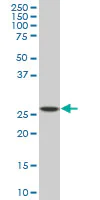 Western blot - Anti-PU.1/Spi1 antibody [2G1] (AB88082)