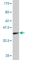 Western blot - Anti-PU.1/Spi1 antibody [2G1] (AB88082), expandable thumbnail