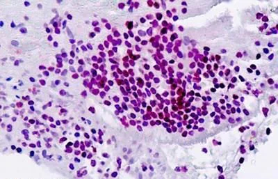 Immunohistochemistry (Formalin/PFA-fixed paraffin-embedded sections) - Anti-PU.1/Spi1 antibody (AB230336)