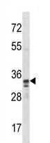 Western blot - Anti-PU.1/Spi1 antibody (AB230336)