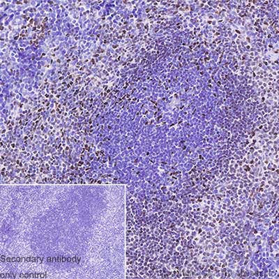 Anti-PU.1/Spi1 antibody - ChIP Grade [EPR22624-20] (ab227835) | Abcam