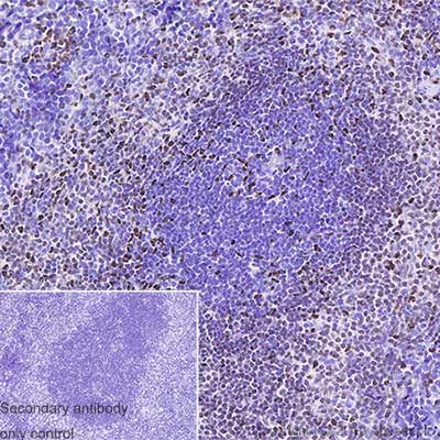 Immunohistochemistry (Formalin/PFA-fixed paraffin-embedded sections) - Anti-PU.1/Spi1 antibody [EPR22624-20] - ChIP Grade - BSA and Azide free (AB264473)