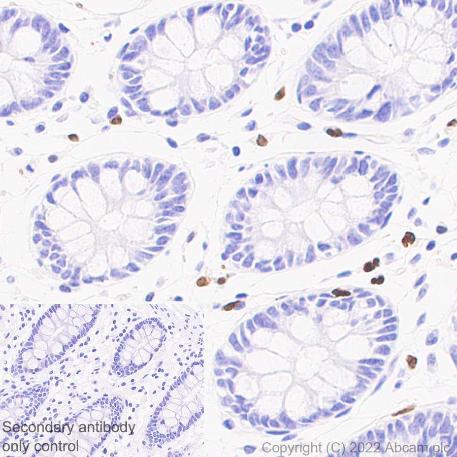 Immunohistochemistry (Formalin/PFA-fixed paraffin-embedded sections) - Anti-PU.1/Spi1 antibody [EPR25123-110] (BSA and Azide free) (ab302624), expandable thumbnail