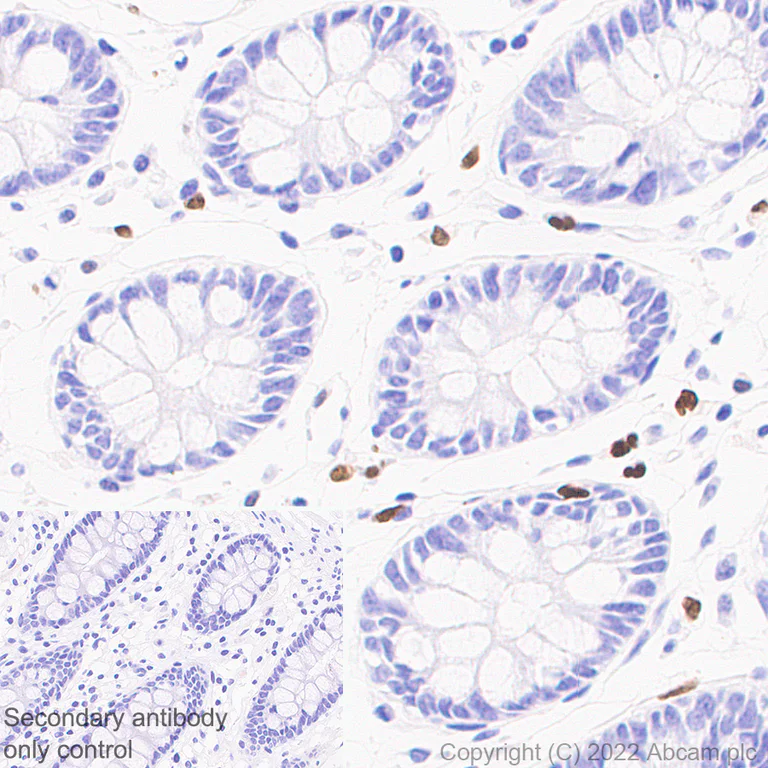 Immunohistochemistry (Formalin/PFA-fixed paraffin-embedded sections) - Anti-PU.1/Spi1 antibody [EPR25123-110] (BSA and Azide free) (AB302624)