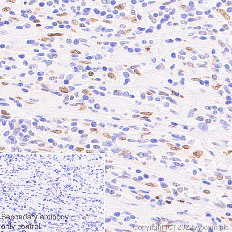 Immunohistochemistry (Formalin/PFA-fixed paraffin-embedded sections) - Anti-PU.1/Spi1 antibody [EPR25123-110] (BSA and Azide free) (ab302624), expandable thumbnail