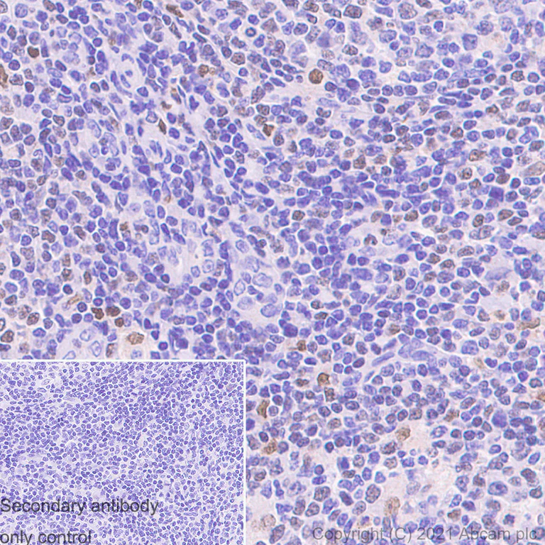 PU.1/Spi1抗体[EPR3158Y] (ab76543)| Abcam中文官网