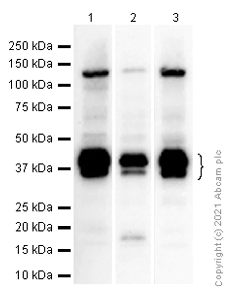 Anti-PU.1/Spi1 antibody [EPR3158Y] (ab76543) | Abcam