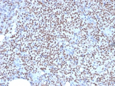 Immunohistochemistry (Formalin/PFA-fixed paraffin-embedded sections) - Anti-PU.1/Spi1 antibody [PU1/2146] (AB238054), expandable thumbnail