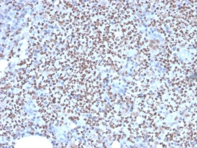 Immunohistochemistry (Formalin/PFA-fixed paraffin-embedded sections) - Anti-PU.1/Spi1 antibody [PU1/2146] (AB238054)